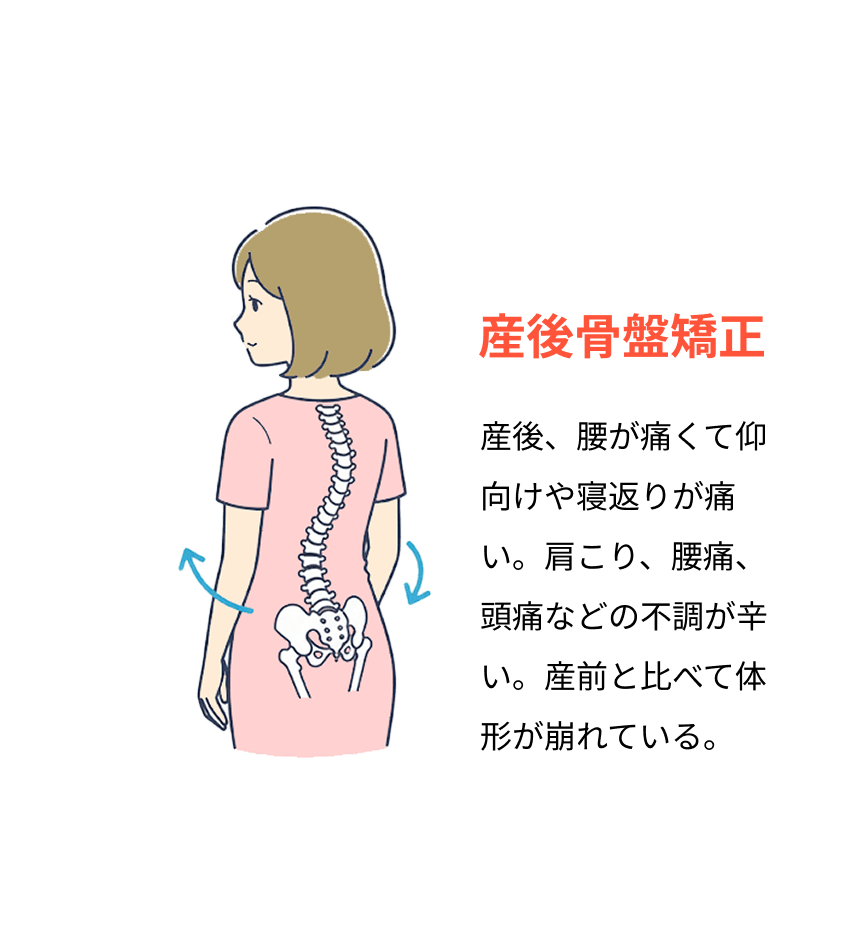 産後骨盤矯正についての説明